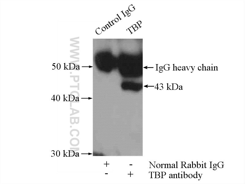 Immunoprecipitation (IP) experiment of COLO 320 cells using TBP Polyclonal antibody (22006-1-AP)