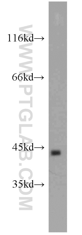 Western Blot (WB) analysis of COLO 320 cells using TBP Polyclonal antibody (22006-1-AP)