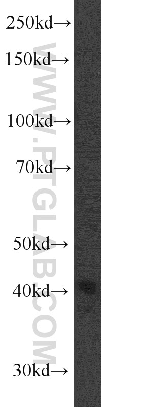 Western Blot (WB) analysis of COLO 320 cells using TBP Polyclonal antibody (22006-1-AP)