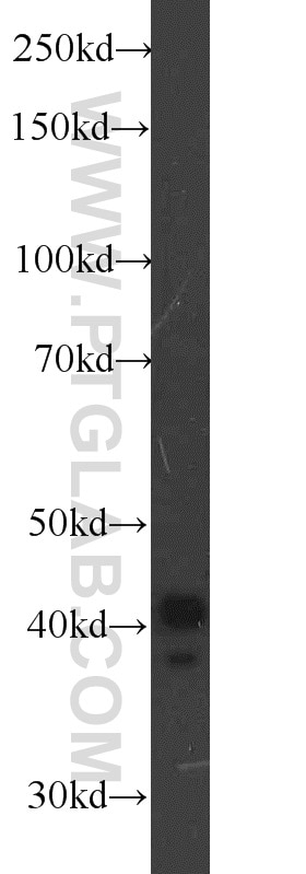 Western Blot (WB) analysis of COLO 320 cells using TBP Polyclonal antibody (22006-1-AP)