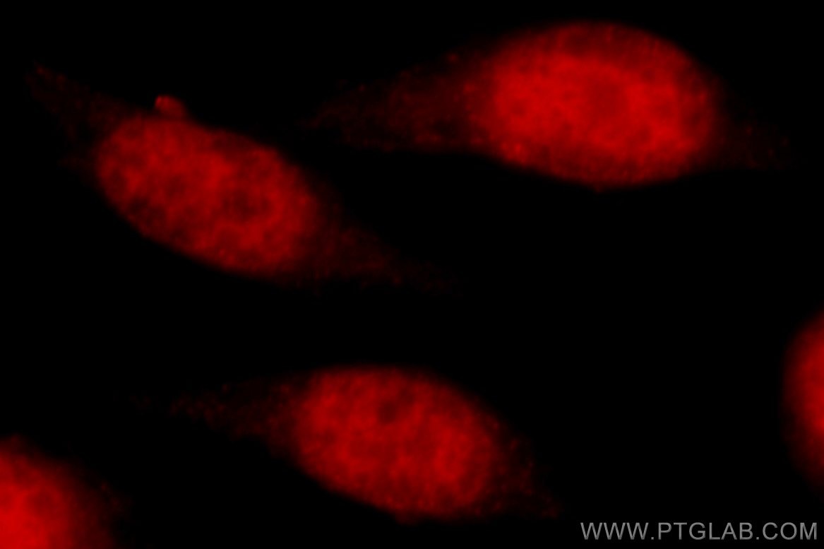 Immunofluorescence (IF) / fluorescent staining of MCF-7 cells using TBP Polyclonal antibody (22246-1-AP)