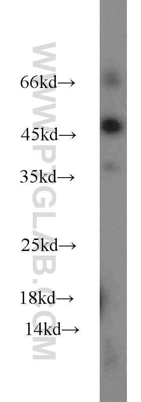 WB analysis of mouse colon using 22246-1-AP