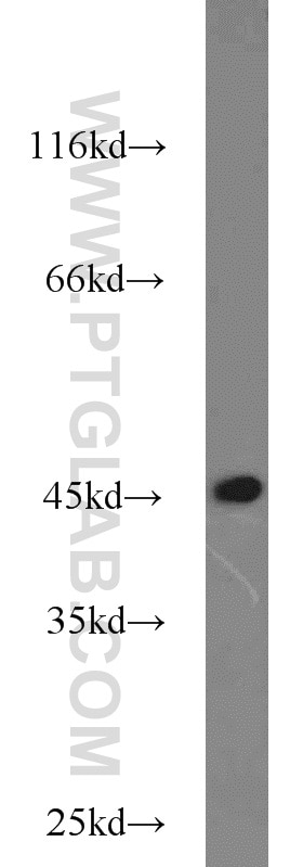 Western Blot (WB) analysis of Jurkat cells using TBP Polyclonal antibody (22246-1-AP)