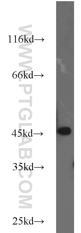 Western Blot (WB) analysis of COLO 320 cells using TBP Polyclonal antibody (22246-1-AP)