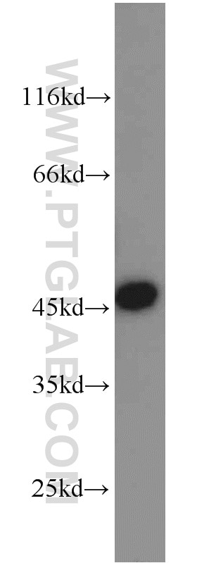 Western Blot (WB) analysis of SKOV-3 cells using TBP Polyclonal antibody (22246-1-AP)