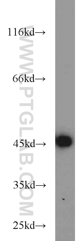 Western Blot (WB) analysis of HeLa cells using TBP Polyclonal antibody (22246-1-AP)