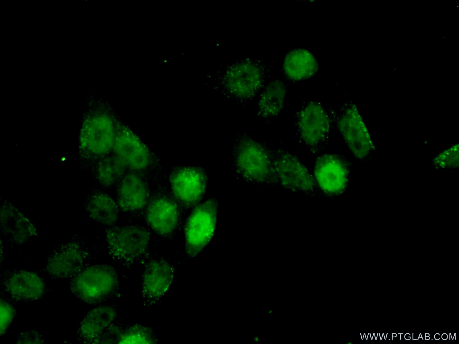 Immunofluorescence (IF) / fluorescent staining of HeLa cells using TBP Monoclonal antibody (66166-1-Ig)