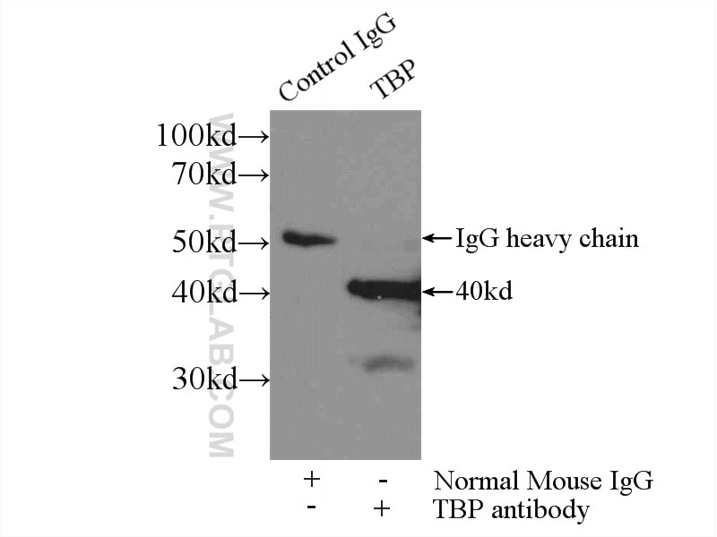 Immunoprecipitation (IP) experiment of HEK-293 cells using TBP Monoclonal antibody (66166-1-Ig)