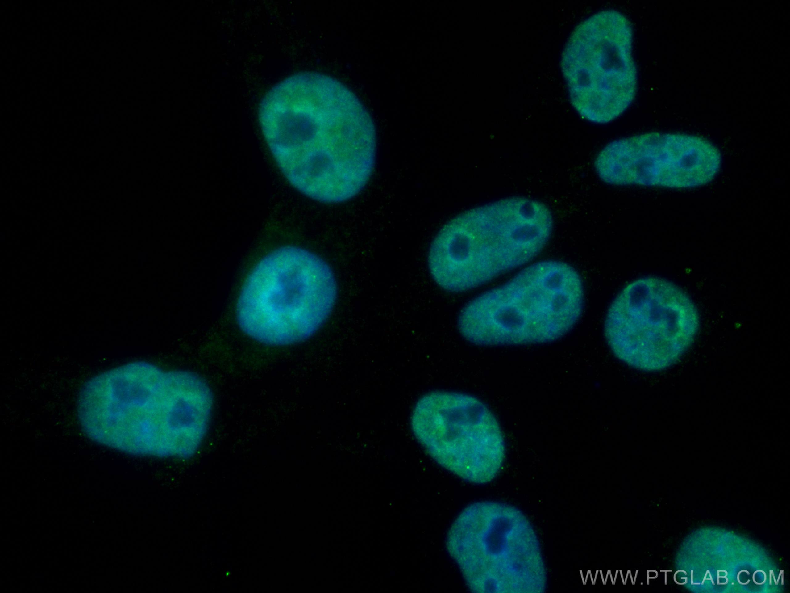 Immunofluorescence (IF) / fluorescent staining of A431 cells using CoraLite® Plus 488-conjugated TBP Monoclonal antib (CL488-66166)