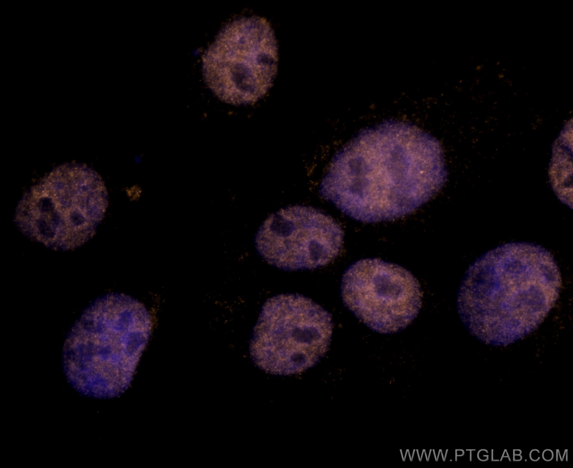 Immunofluorescence (IF) / fluorescent staining of A431 cells using CoraLite®555-conjugated TBP Monoclonal antibody (CL555-66166)
