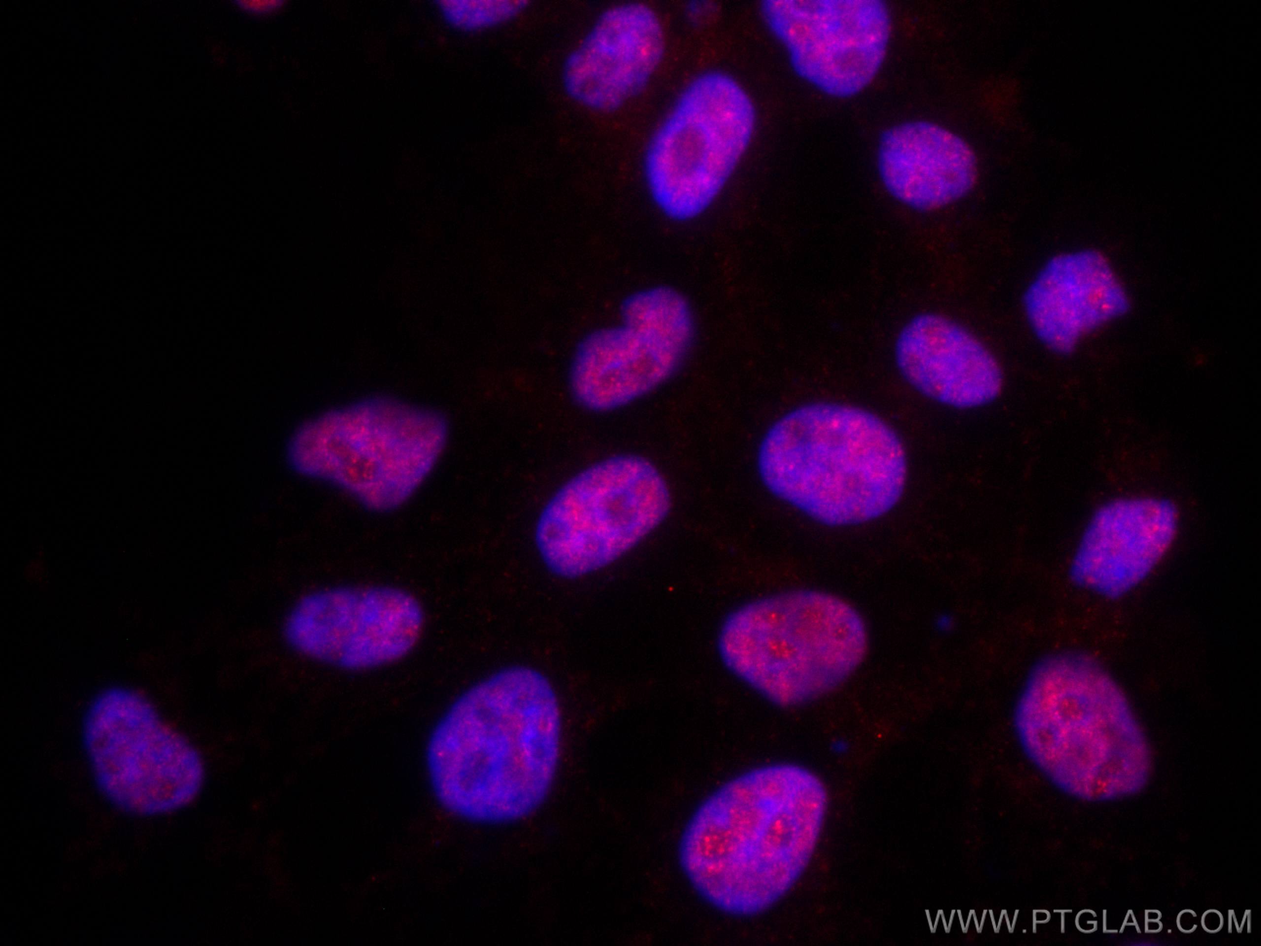 Immunofluorescence (IF) / fluorescent staining of A431 cells using CoraLite®594-conjugated TBP Monoclonal antibody (CL594-66166)