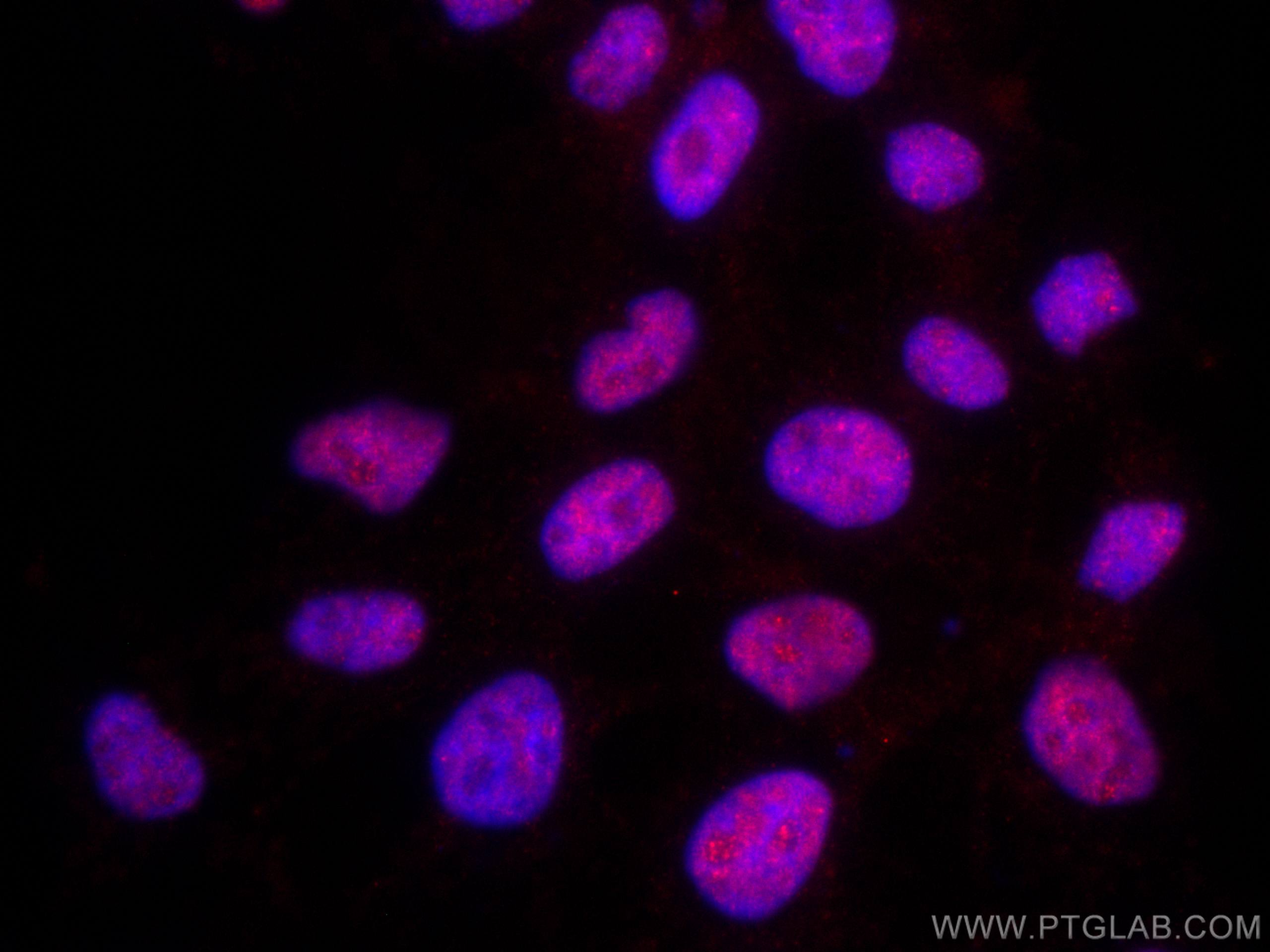 IF Staining of A431 using CL594-66166