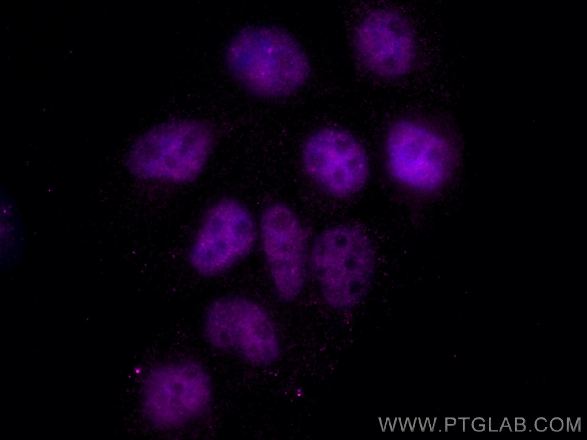 Immunofluorescence (IF) / fluorescent staining of A431 cells using CoraLite® Plus 647-conjugated TBP Monoclonal antib (CL647-66166)