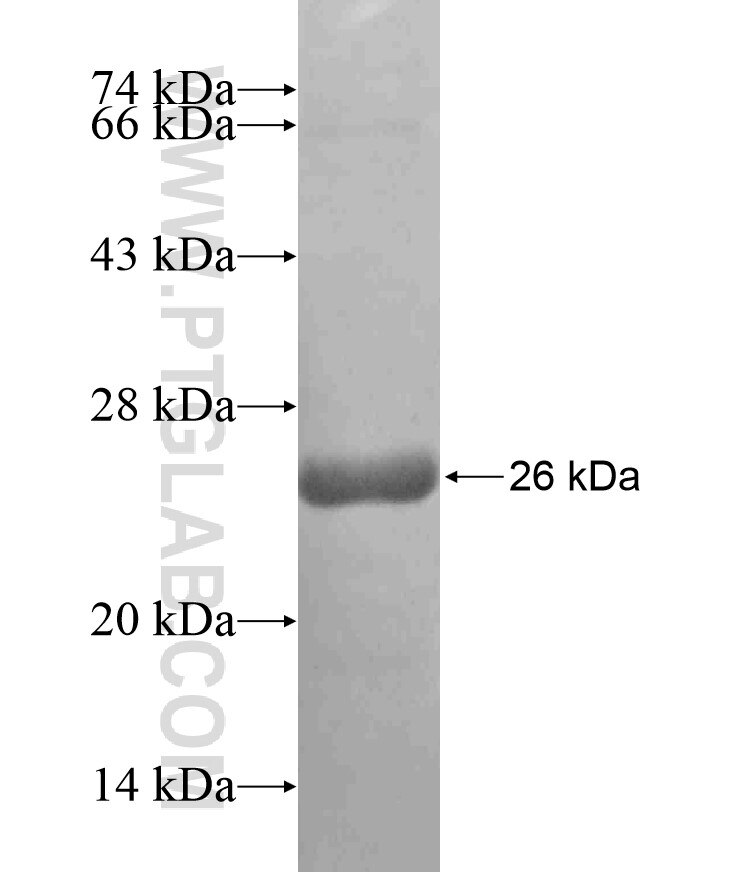 TBP fusion protein Ag18052 SDS-PAGE