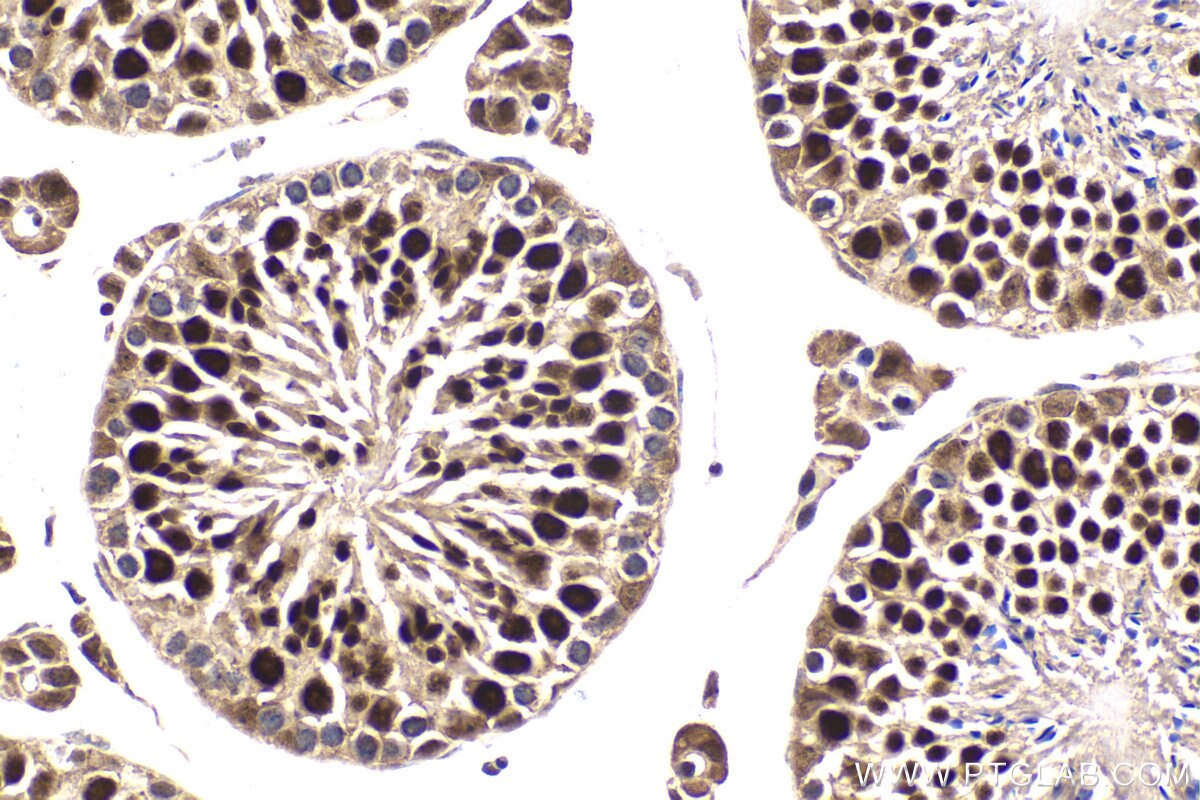 Immunohistochemistry (IHC) staining of mouse testis tissue using TBPL1 Polyclonal antibody (12258-1-AP)