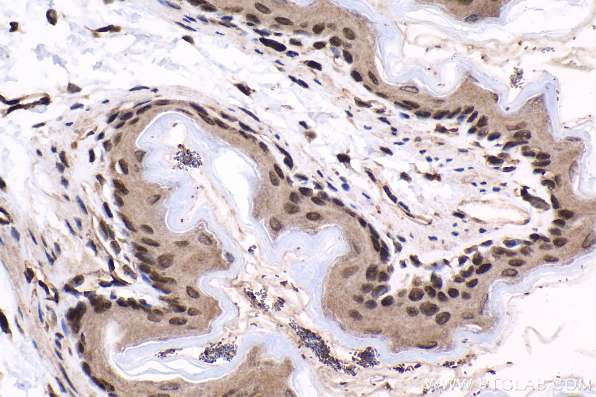 Immunohistochemistry (IHC) staining of mouse stomach tissue using TBPL1 Polyclonal antibody (12258-1-AP)