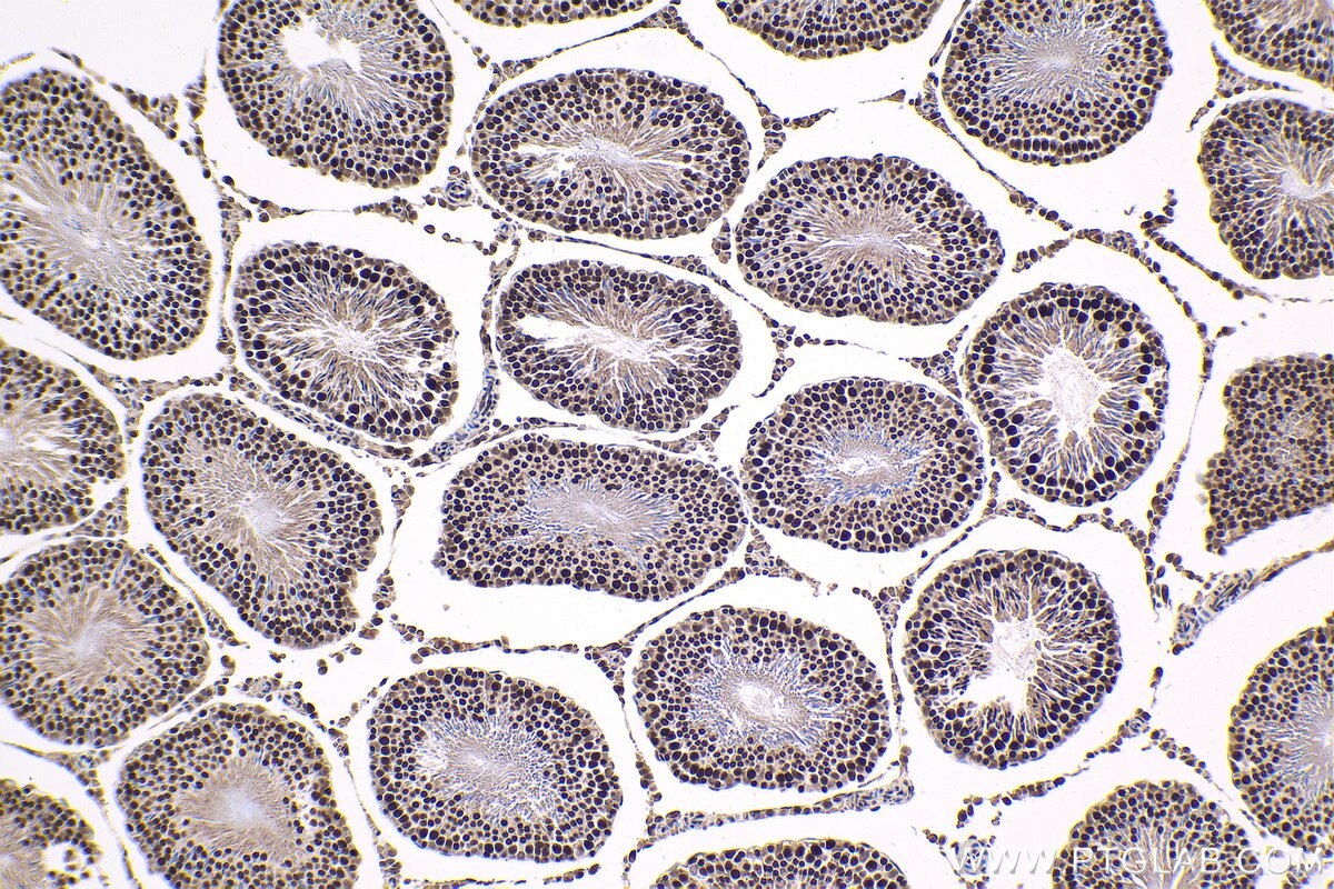 IHC staining of rat testis using 12258-1-AP