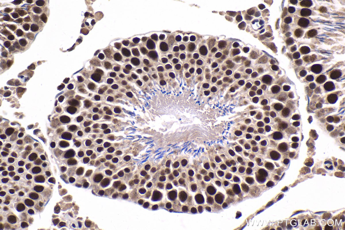 IHC staining of rat testis using 12258-1-AP