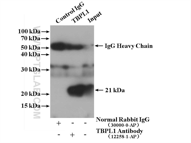 Immunoprecipitation (IP) experiment of mouse testis tissue using TBPL1 Polyclonal antibody (12258-1-AP)