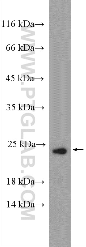 Western Blot (WB) analysis of mouse testis tissue using TBPL1 Polyclonal antibody (12258-1-AP)