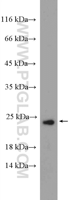 Western Blot (WB) analysis of mouse testis tissue using TBPL1 Polyclonal antibody (12258-1-AP)