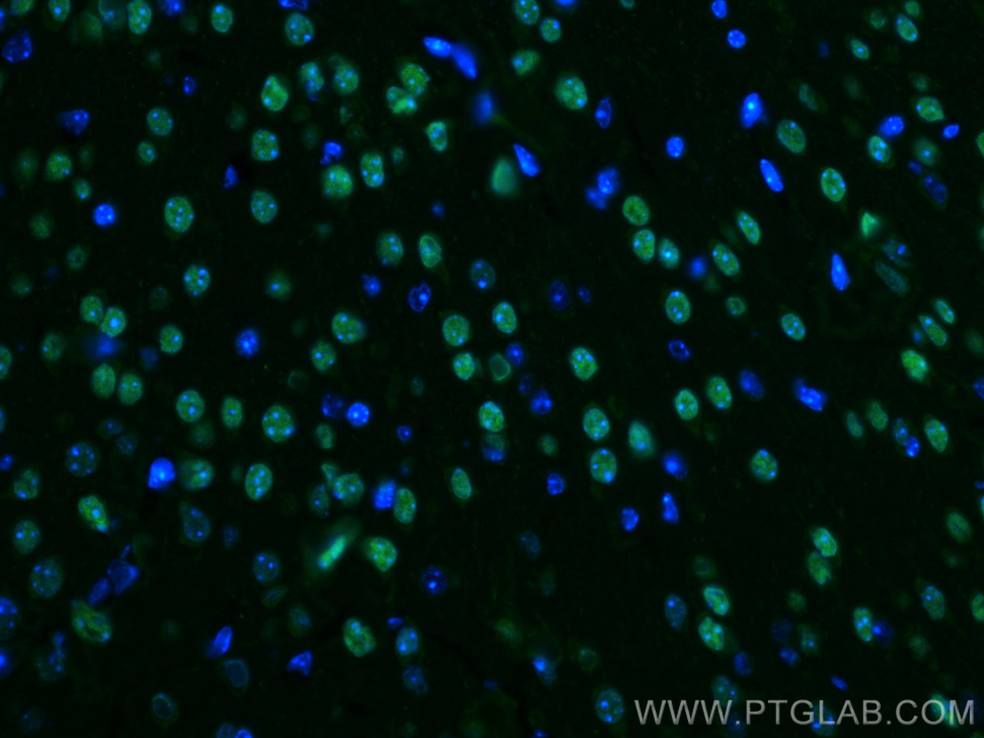 Immunofluorescence (IF) / fluorescent staining of mouse brain tissue using TBR1 Polyclonal antibody (20932-1-AP)