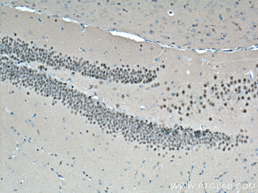 Immunohistochemistry (IHC) staining of mouse brain tissue using TBR1 Polyclonal antibody (20932-1-AP)
