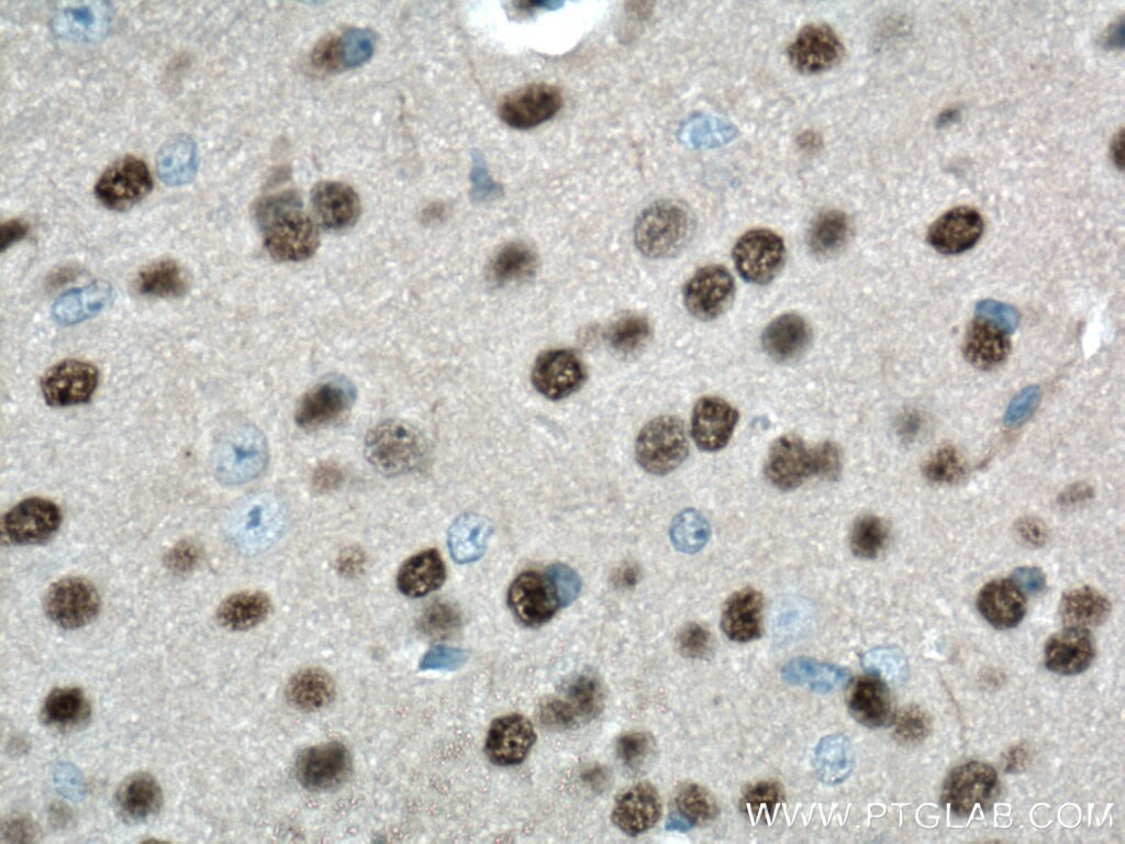 Immunohistochemistry (IHC) staining of mouse brain tissue using TBR1 Polyclonal antibody (20932-1-AP)