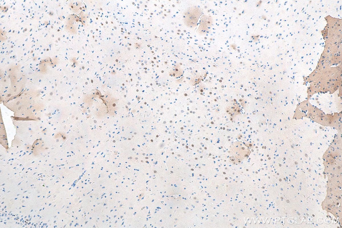 Immunohistochemistry (IHC) staining of rat brain tissue using TBR1 Polyclonal antibody (20932-1-AP)