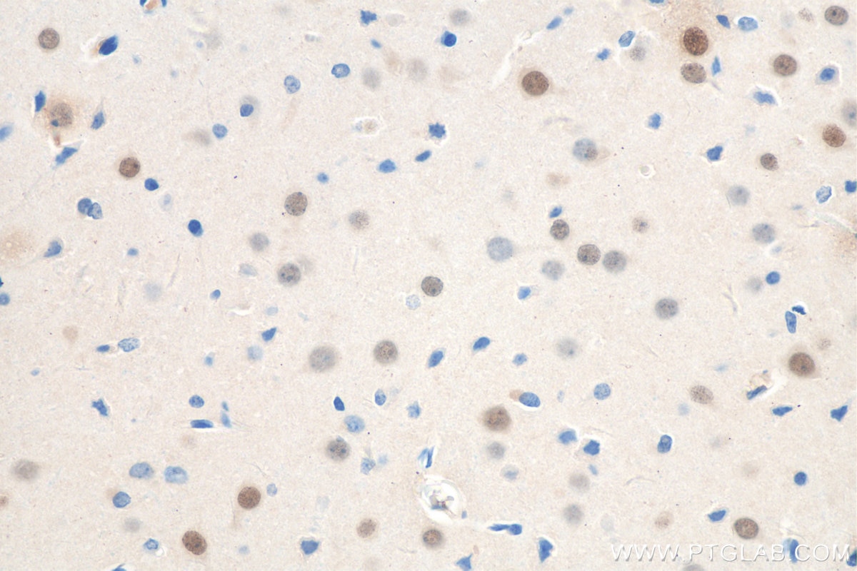 IHC staining of rat brain using 20932-1-AP