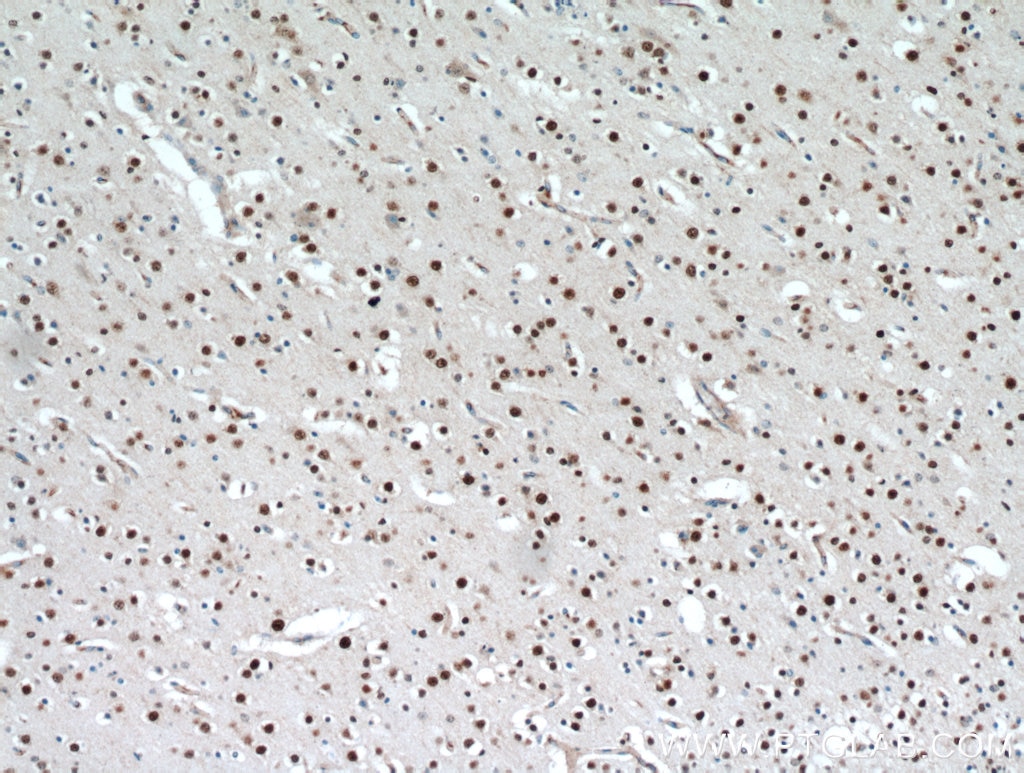 Immunohistochemistry (IHC) staining of human brain tissue using TBR1 Polyclonal antibody (20932-1-AP)