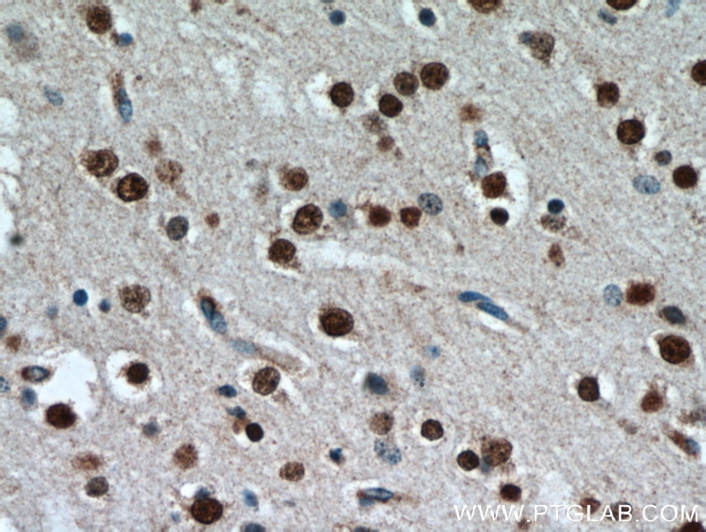 Immunohistochemistry (IHC) staining of human brain tissue using TBR1 Polyclonal antibody (20932-1-AP)