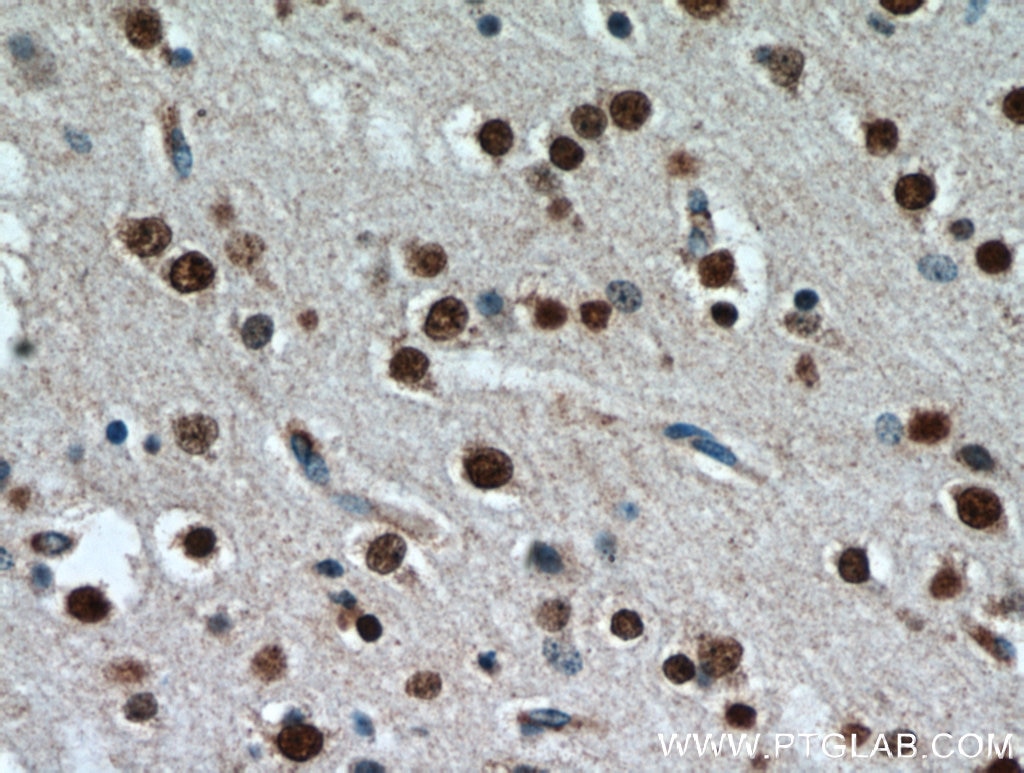 IHC staining of human brain using 20932-1-AP