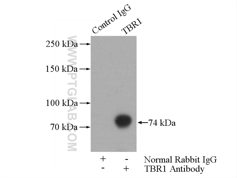 Immunoprecipitation (IP) experiment of mouse brain tissue using TBR1 Polyclonal antibody (20932-1-AP)