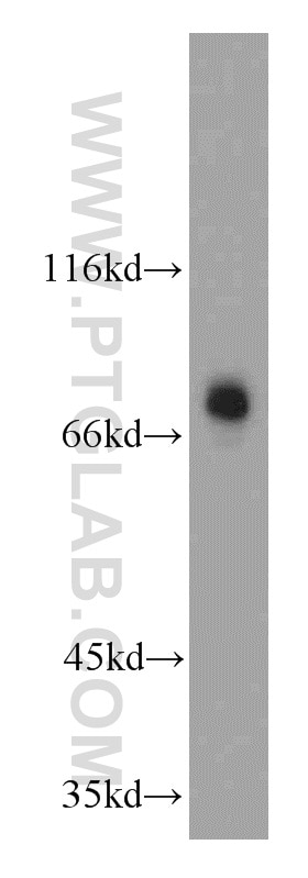 Western Blot (WB) analysis of mouse brain tissue using TBR1 Polyclonal antibody (20932-1-AP)