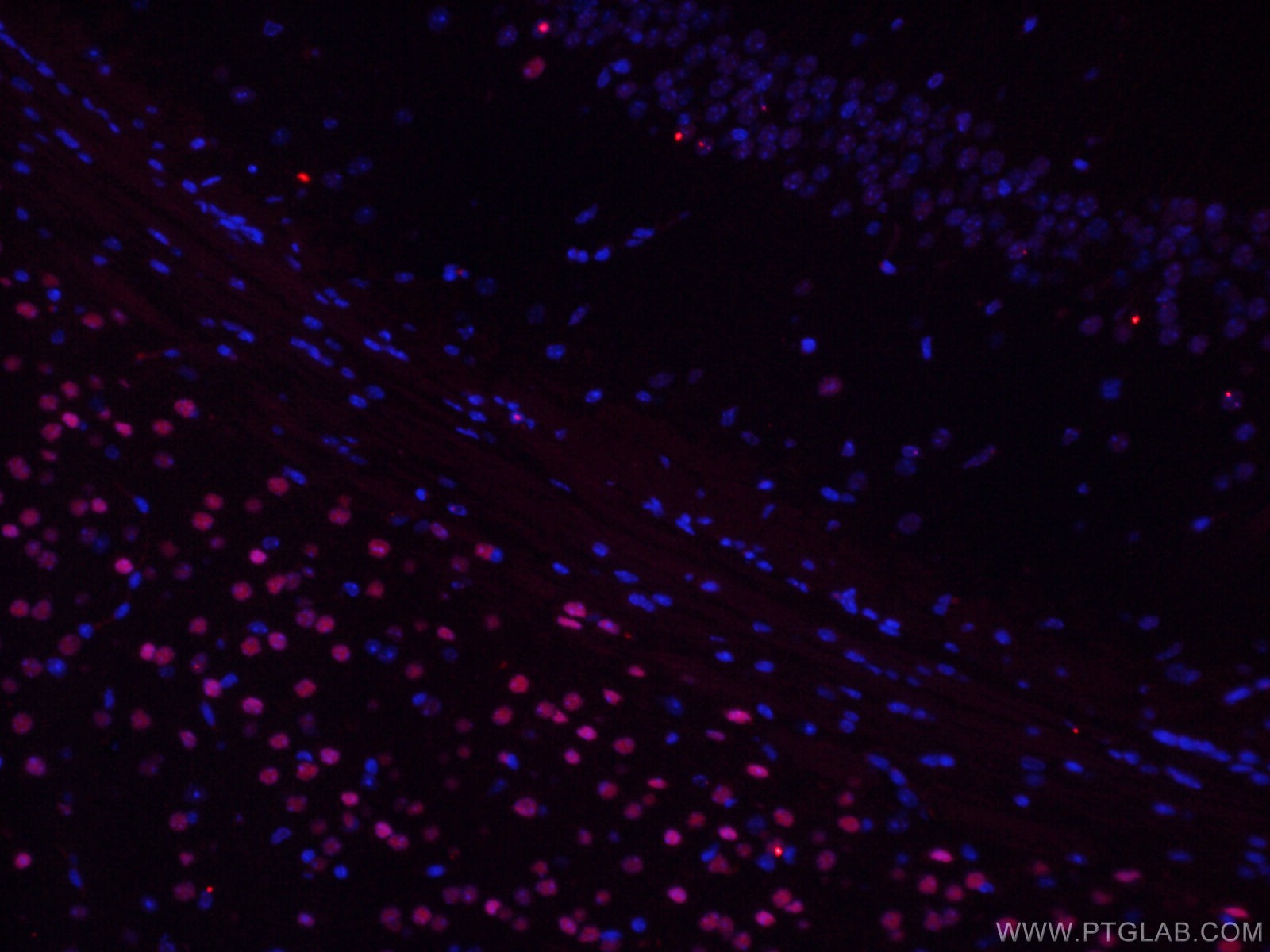 Immunofluorescence (IF) / fluorescent staining of mouse brain tissue using TBR1 Monoclonal antibody (66564-1-Ig)