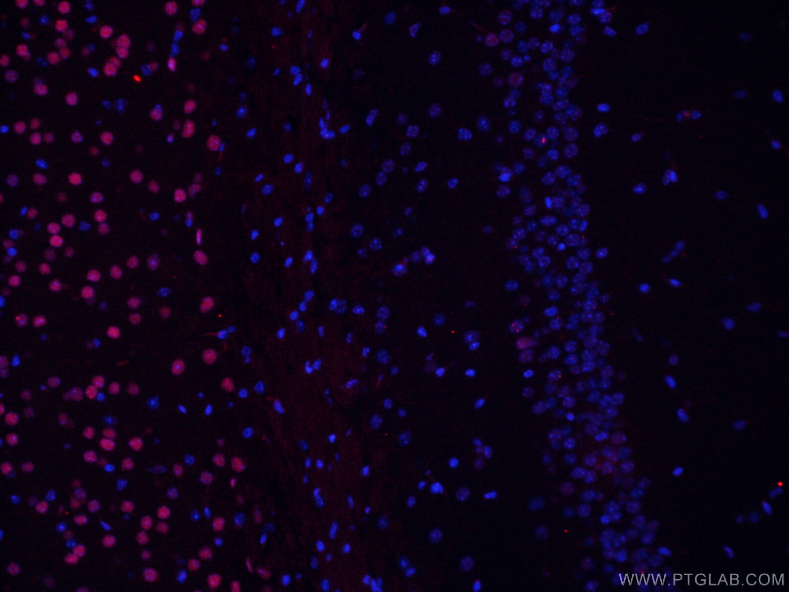 Immunofluorescence (IF) / fluorescent staining of mouse brain tissue using TBR1 Monoclonal antibody (66564-1-Ig)