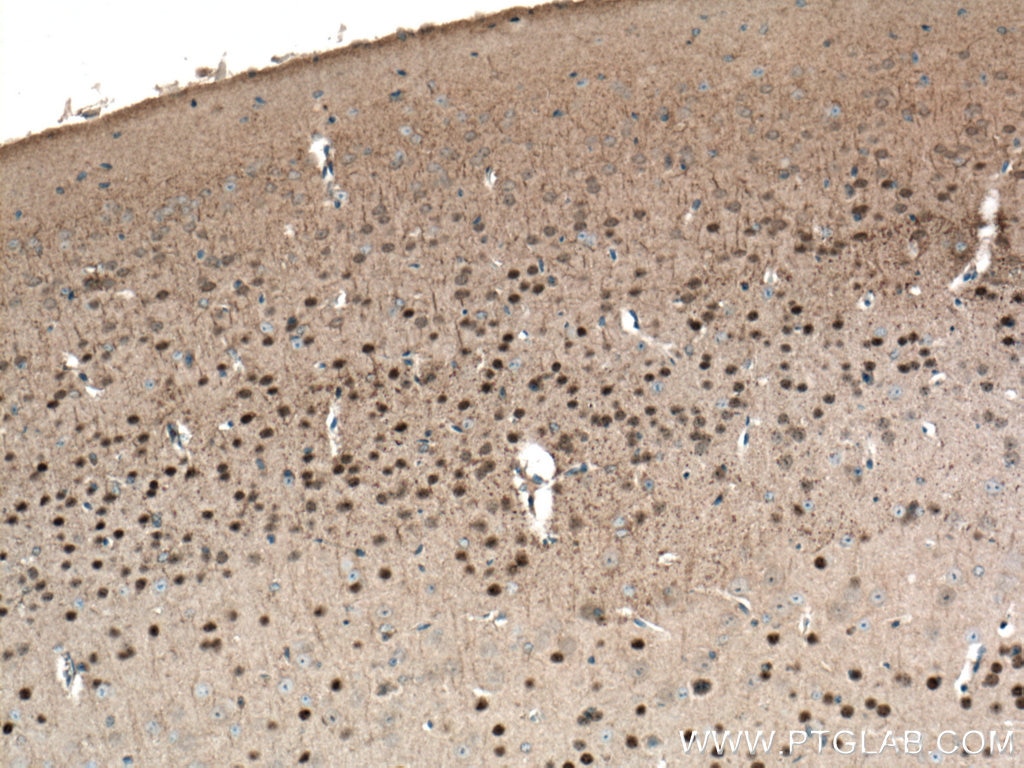 Immunohistochemistry (IHC) staining of mouse brain tissue using TBR1 Monoclonal antibody (66564-1-Ig)