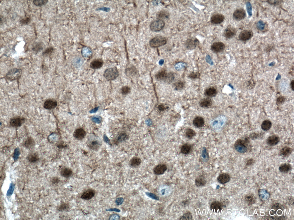 Immunohistochemistry (IHC) staining of mouse brain tissue using TBR1 Monoclonal antibody (66564-1-Ig)