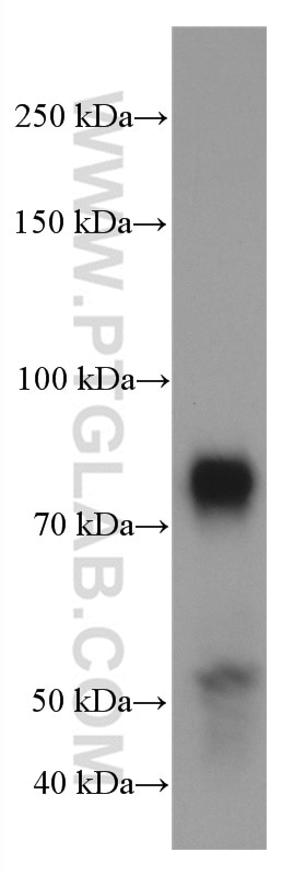 Western Blot (WB) analysis of rat cerebellum tissue using TBR1 Monoclonal antibody (66564-1-Ig)