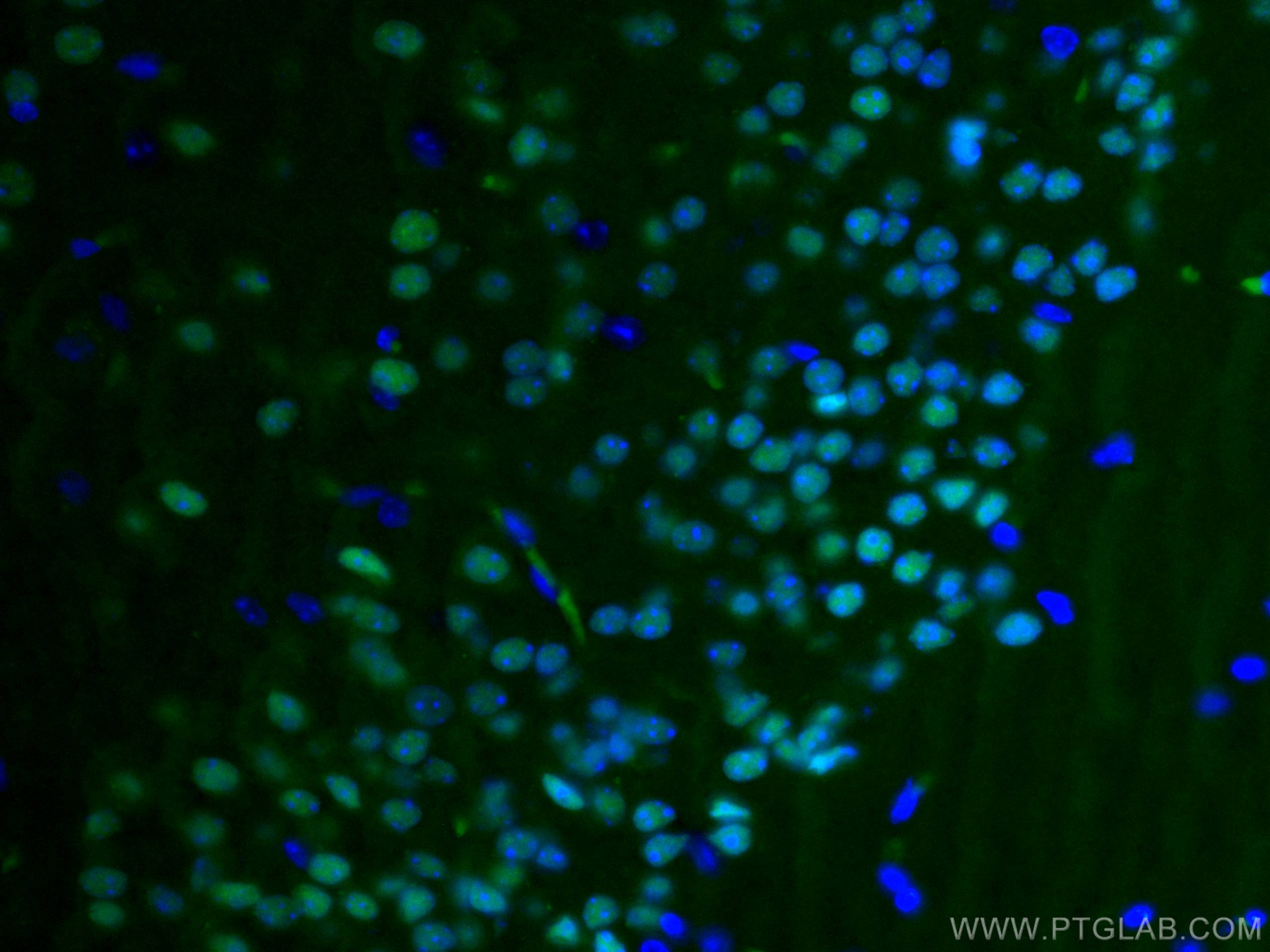 IF Staining of mouse brain using CL488-20932
