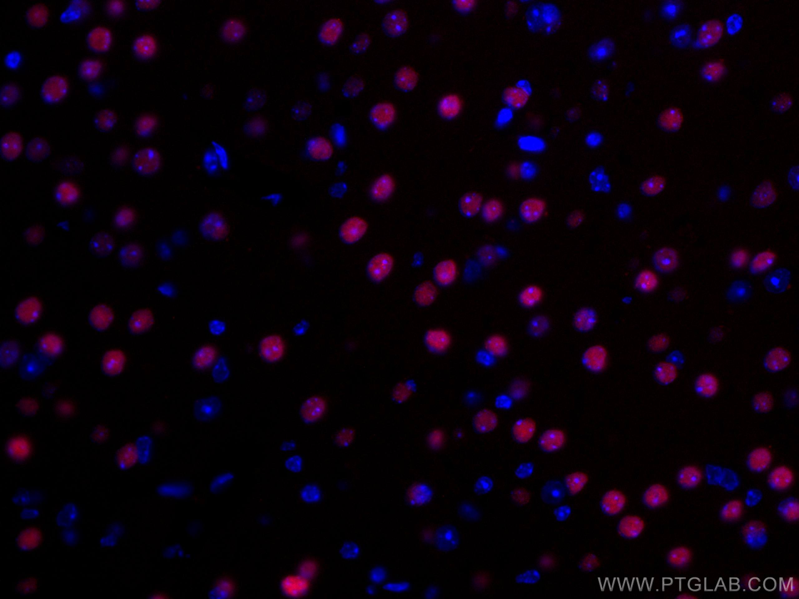 Immunofluorescence (IF) / fluorescent staining of mouse brain tissue using CoraLite®594-conjugated TBR1 Polyclonal antibody (CL594-20932)
