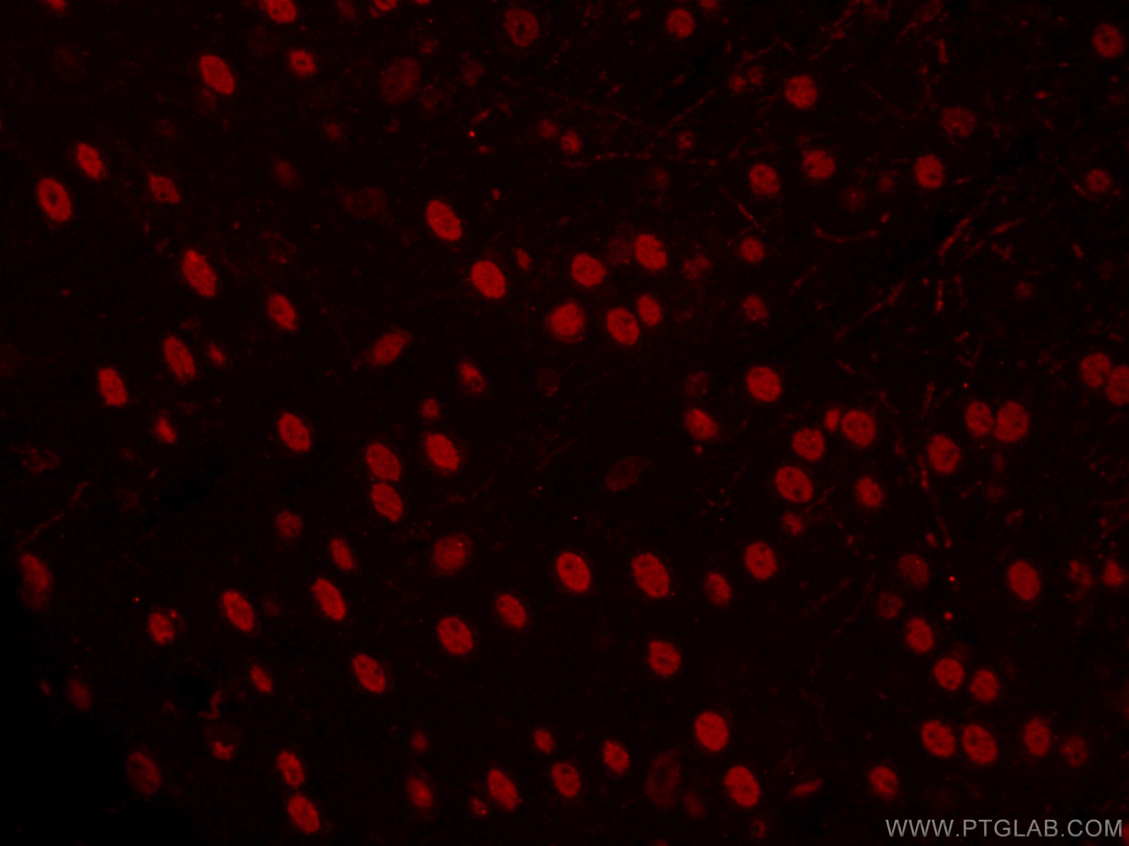 IF Staining of mouse brain using CL594-66564