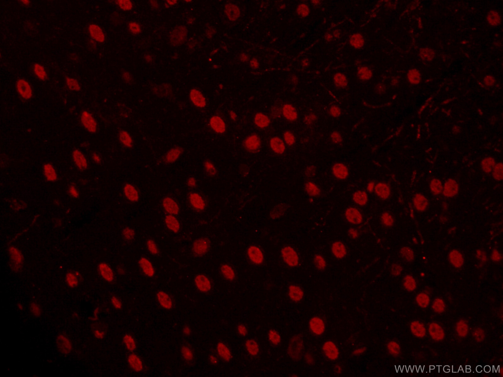 Immunofluorescence (IF) / fluorescent staining of mouse brain tissue using CoraLite®594-conjugated TBR1 Monoclonal antibody (CL594-66564)