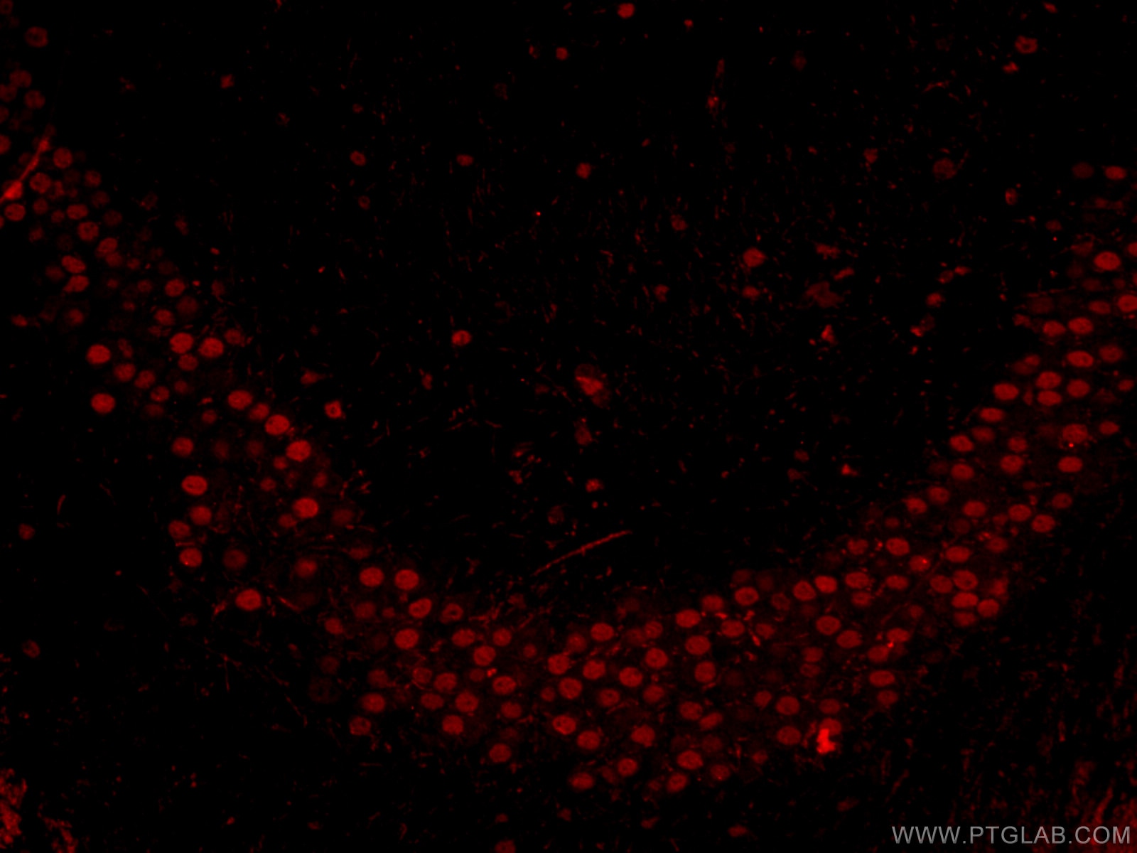 Immunofluorescence (IF) / fluorescent staining of mouse brain tissue using CoraLite®594-conjugated TBR1 Monoclonal antibody (CL594-66564)