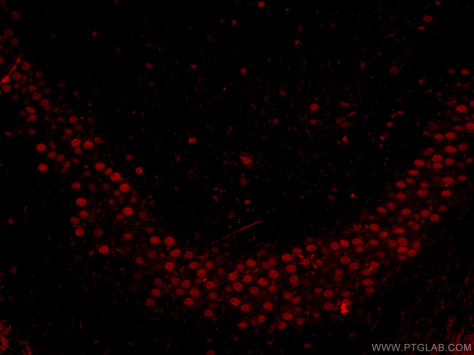 IF Staining of mouse brain using CL594-66564