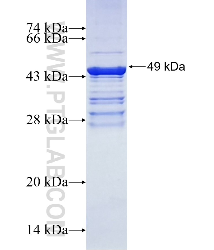 TBR1 fusion protein Ag14935 SDS-PAGE