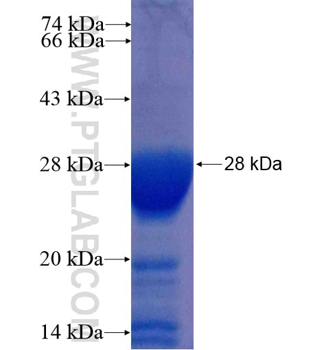 TBR1 fusion protein Ag15262 SDS-PAGE