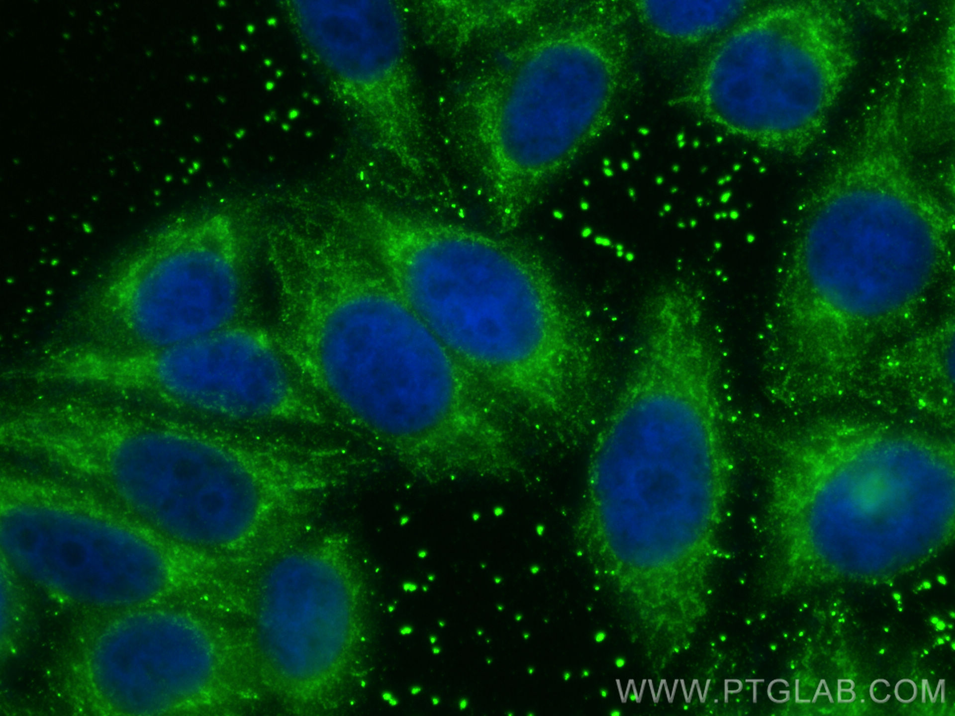 Immunofluorescence (IF) / fluorescent staining of HepG2 cells using TBRG4 Polyclonal antibody (10177-2-AP)