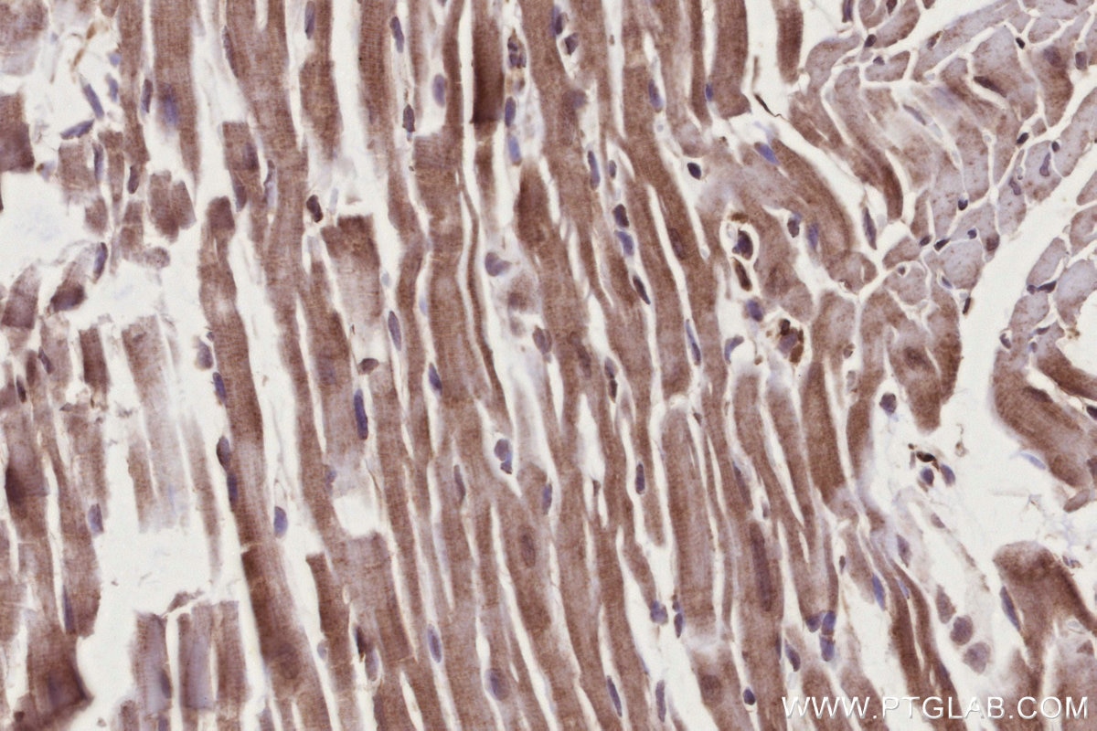 Immunohistochemistry (IHC) staining of mouse heart tissue using TBRG4 Polyclonal antibody (10177-2-AP)